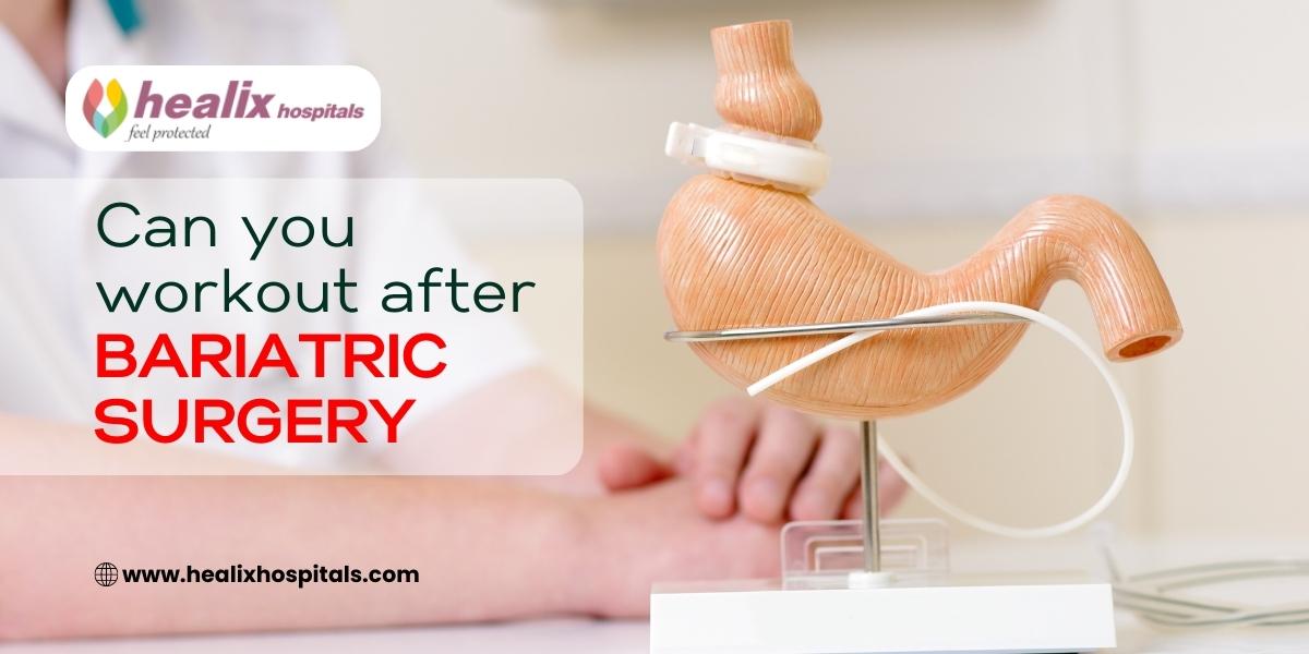 Can you workout after Bariatric Surgery? Healix Hospitals